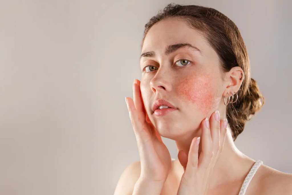 Reducing Inflammation