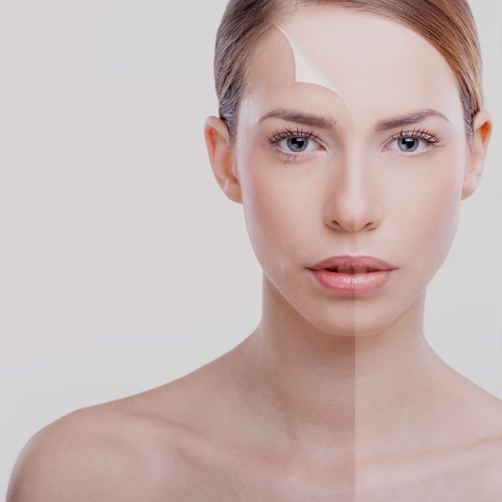 Brightening the Skin with Rose Oil
